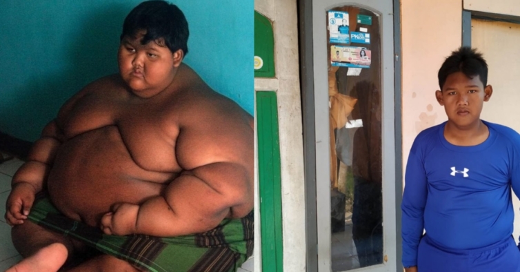 Era o menino mais gordo do mundo mas j perdeu mais de cem quilos NiT